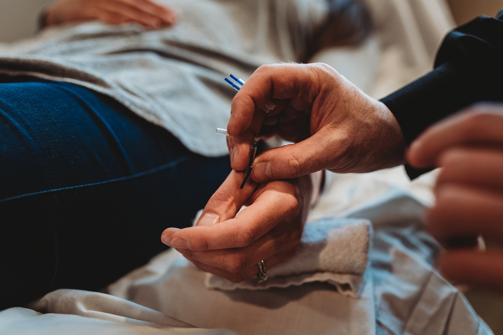 Aldergrove Acupuncture Services